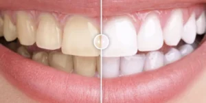 Before After Image Comparison WP Plugin 1.0.1破解版插件
